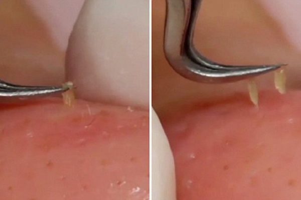 Очистить поры от ужасных загрязнений теперь проще простого! Сияющая кожа уже через 7 дней.