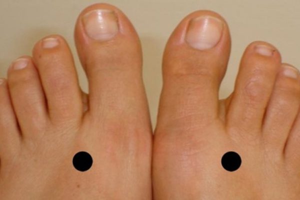 Он нажал на эти точки на ногах, после чего его страдания закончились!