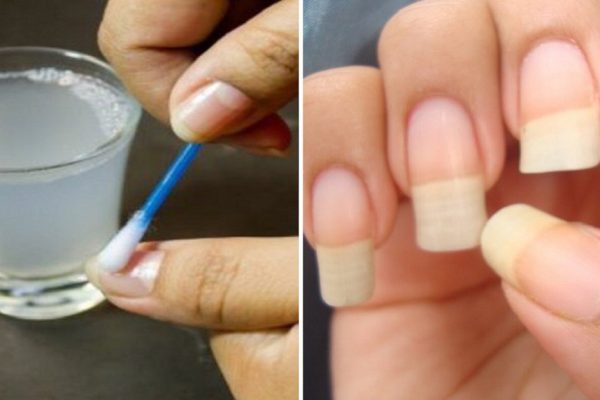 Как быстро отрастить ногти, которые никогда не сломаются: поможет простое средство из 4 компонентов!