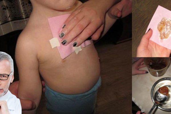 Мама сделала ребенку этот компресс на ночь. То, что произошло утром, — поразительно!