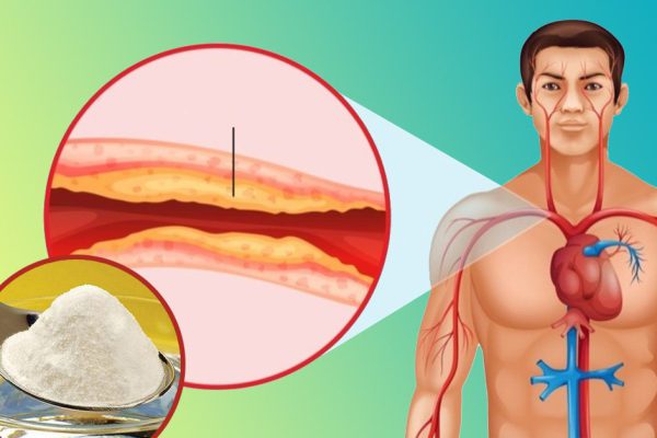 Лучший рецепт очищения крови от холестерина при помощи чайной заварки! Вымывает из крови все соли.