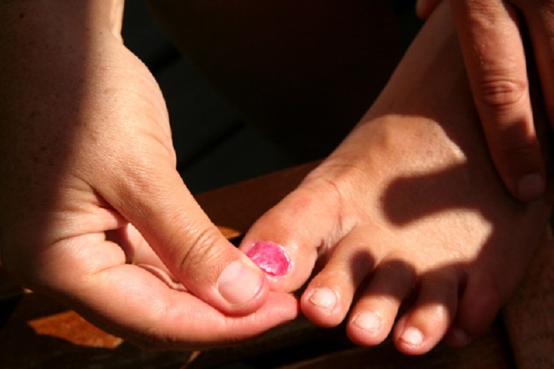 ноготь на ноге