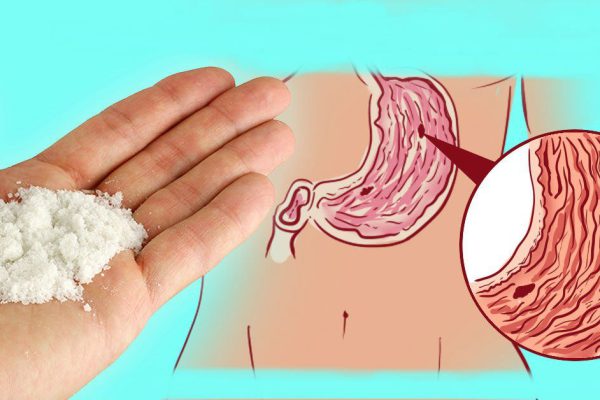 11 невероятных способов применения пищевой соды! Мой лучший лекарь в трудную минуту…