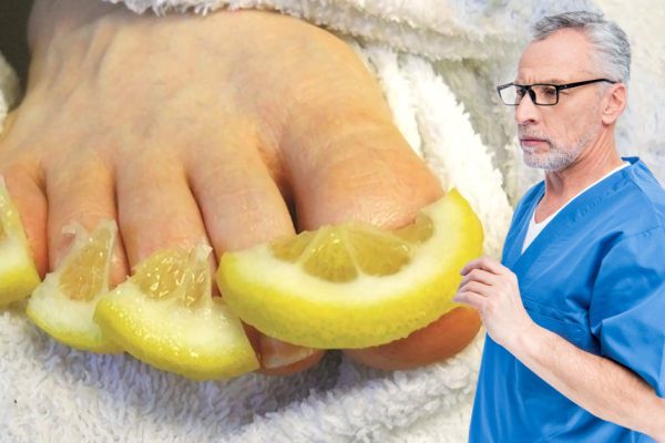 Уничтожь грибок ногтей за 14 дней полностью! В составе лимона присутствуют вещества…