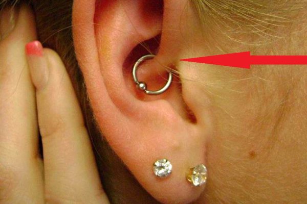 Стоит лишь проколоть ухо в этом месте, и ты забудешь о недуге!