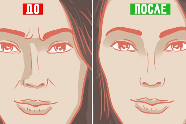 Предотвратить пластику и растяжки можно, если взять это за привычку…