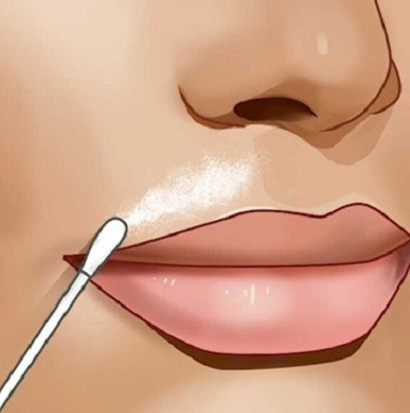 удаление волос на лице