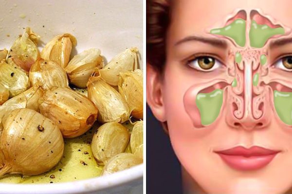 Вкусный чесночный суп: беспощадное средство, которое поможет избавиться от простуды!