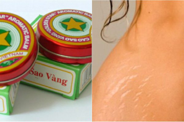 Она натирает живот бальзамом «Звездочка»… Причина тебя точно удивит!