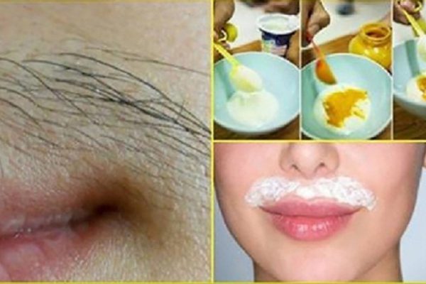 Как навсегда избавиться от нежелательных волос на лице: проверенный рецепт восточных красавиц.