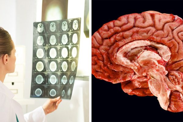 Врачи рассказали, как остановить старение! Всё дело в этом ежедневном процессе…