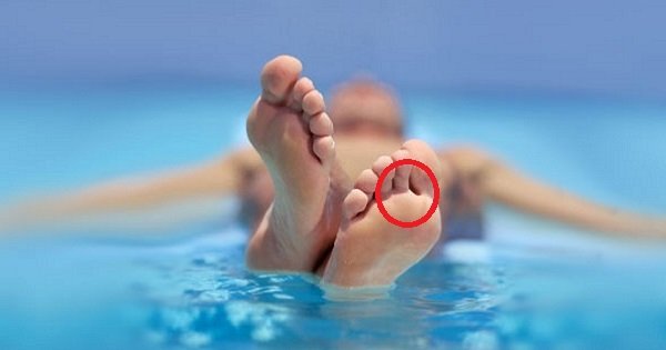 Как избежать заражения грибком стопы: важно знать всем, кто собрался в отпуск!