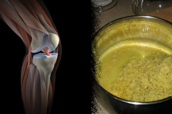 Уникальное средство для ленивых. Когда боль в суставах замучила, помогут эти 3 компонента…