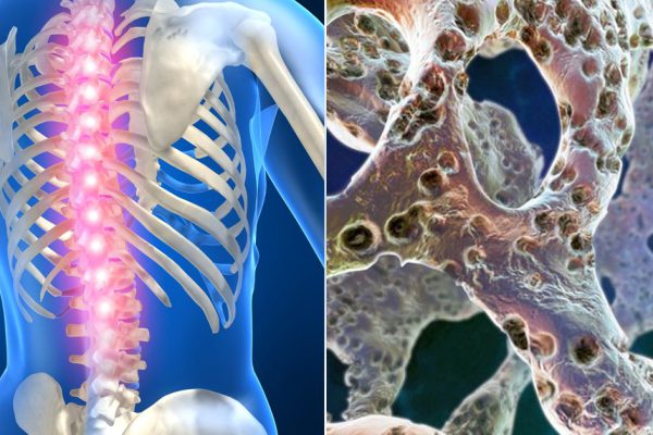 Она употребляла 1 столовую ложку этого средства 3 раза в день. То, что произошло через месяц, восхищает!