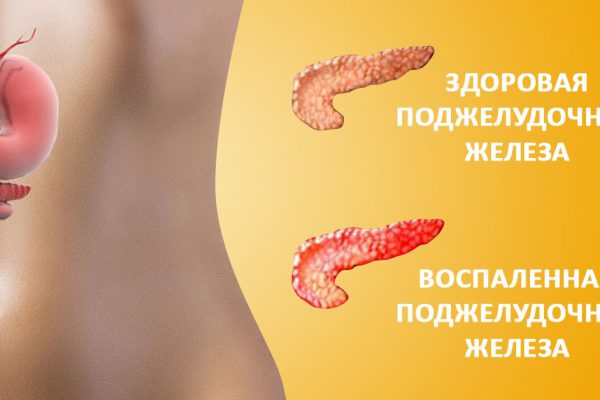 С поджелудочной железой шутить нельзя! Благодаря этому рецепту важнейший орган станет неуязвимым…