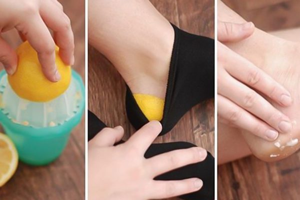 Она засунула лимонную корочку в носок… Когда я узнала, зачем ей это, была в восторге!