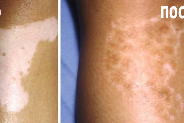 Женщина развела настоящее болото в аквариуме. Причина — в чудодейственном исцелении!