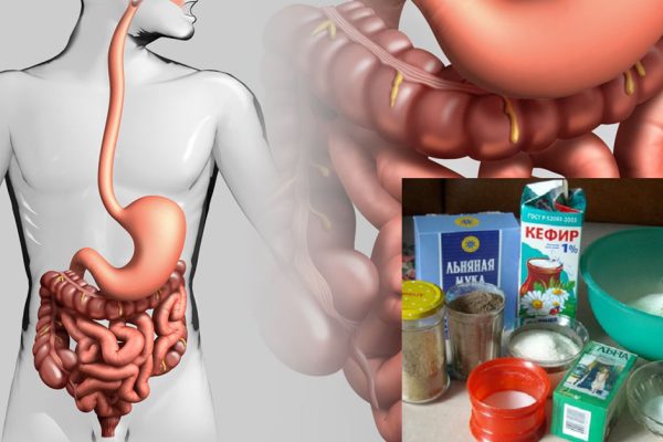 Здоровый кишечник — фундамент крепкого здоровья! Чтобы выглядеть моложе своих лет и иметь красивое…
