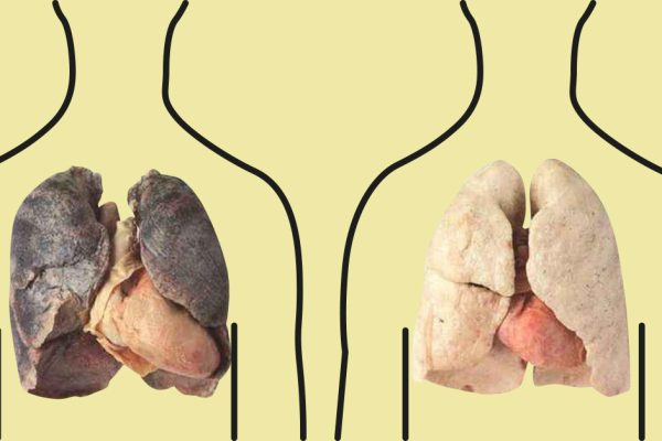 4 продукта, которые очищают легкие: курильщикам обязательно к прочтению!