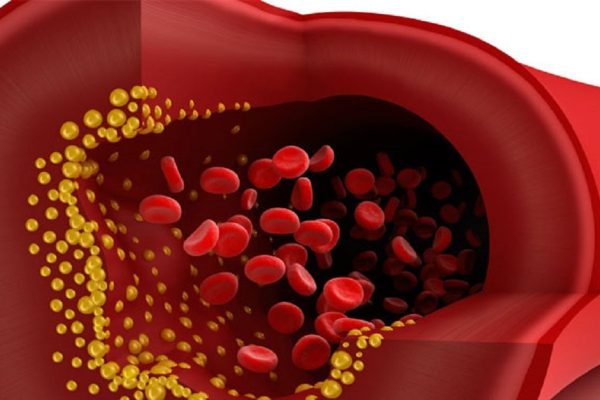 Мама долго страдала от высокого холестерина, пока бабушка не дала ей это лекарство…