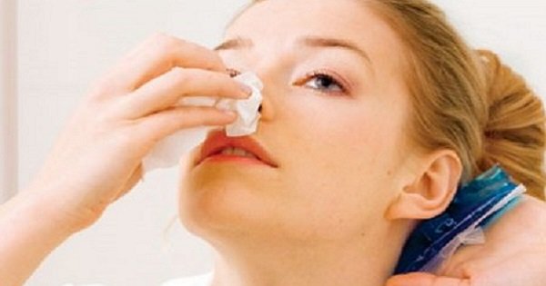 Как остановить носовое кровотечение. Это должен знать каждый!