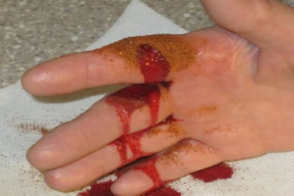 Трюк, который поможет остановить кровотечение за 10 секунд: безотказный метод!