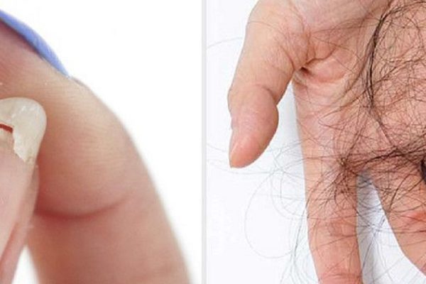 Волшебный рецепт от выпадения волос, ломких ногтей и бессонницы!