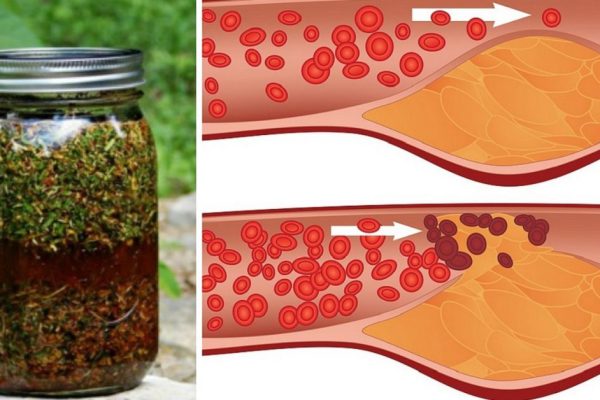 Укроп, мёд и валериана! Всего 1 столовая ложка сотворит чудо с твоими сосудами.