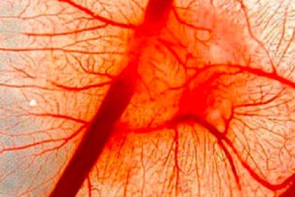 Восстановить эластичность сосудов срочно! Это народное средство вернет былую прыть за 3 дня.