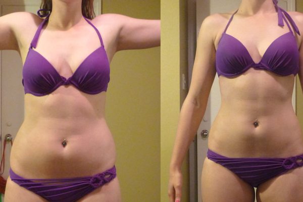 Экспресс-подготовка к пляжному сезону! Нужно всего лишь исключить из рациона эти 6 продуктов.