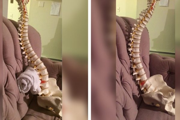Хирург был ошарашен! Выпрямил позвоночник и простился с ужасным выпирающим животом, а всё потому…