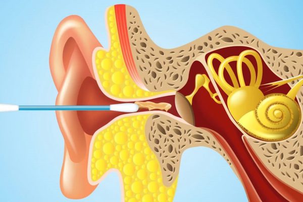 Посмотрев на это, ты откажешься от использования ватных палочек для ушей раз и навсегда!