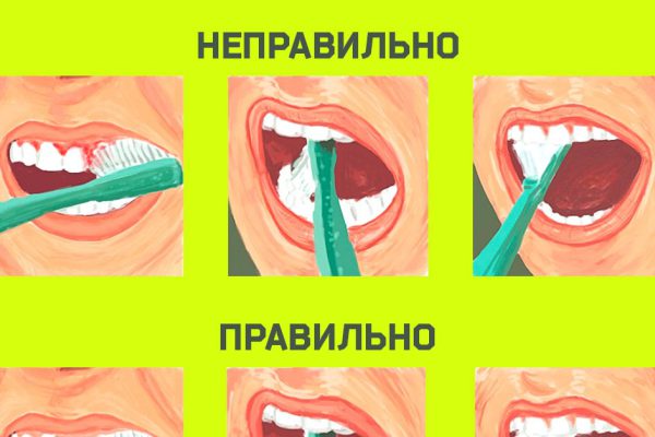 Всю жизнь ты чистил зубы неправильно! Благодаря этой схеме всё меняется…