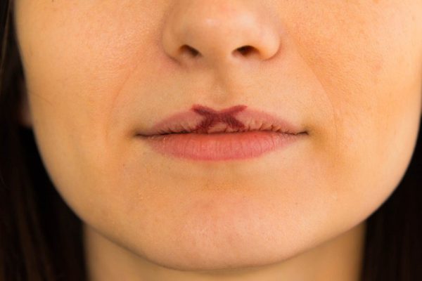 Она нарисовала крестик на губе… Увидев этот способ, ты будешь делать так же!