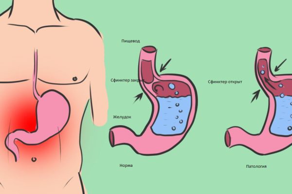 Самый дешевый способ похудеть! Достаточно просто научиться правильно…