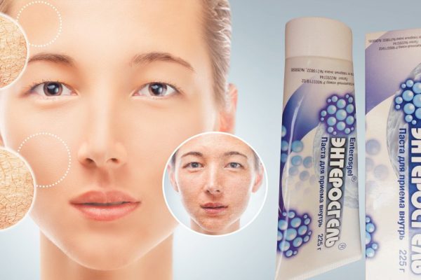 Наношу «Энтеросгель» тостым слоем на лицо и принимаю ложку натощак. Он очищает лицо лучше моего косметолога!