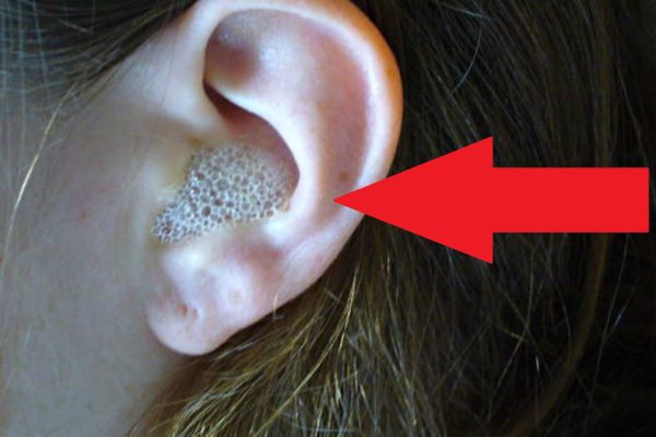 Всего 3 капли этого средства, закапанные в ухо, дают невероятный эффект!