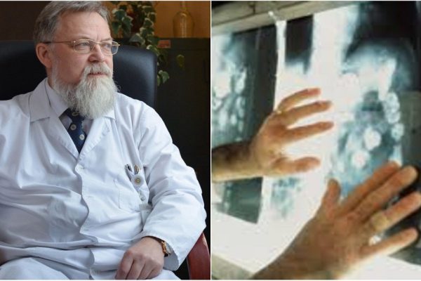 Онколог-инноватор рассказал, возможно ли вовремя разглядеть рак и есть ли смысл… Умно!