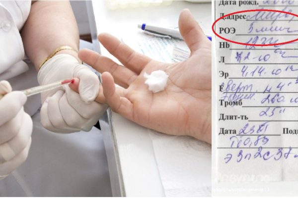 9 показателей крови, которые расскажут всё о здоровье: читай анализ правильно!