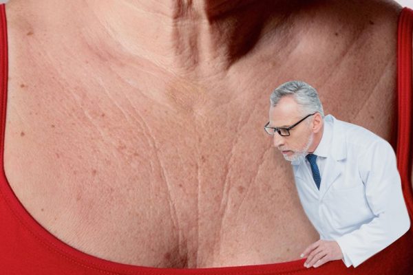 Эти потрясающие средства устраняют морщины на груди и шее, вы сразу себя почувствуете моложе, милые дамы!