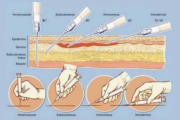 Как правильно делать инъекции? Непременно сохрани себе эту информацию, пригодится!