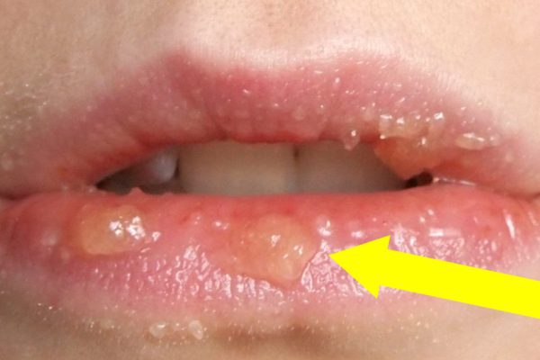 Если ты заметишь у себя эти признаки, лучше сразу обратиться к врачу!