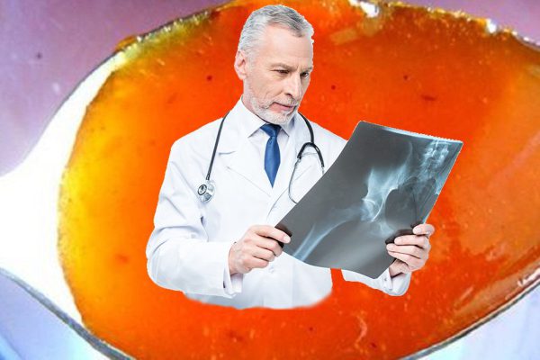 «Гипертоники, прекращайте! Пока не стукнул инсульт, следует…» Рекомендация преданного врача.