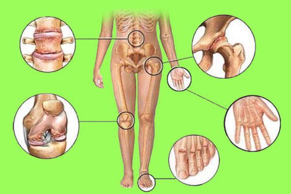 Артрит и артроз исчезают без следа! Знаменитый ортопед дал домашний рецепт для устранения…