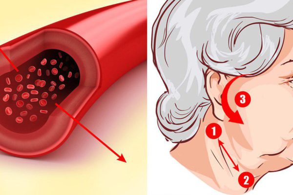 Японские врачи: «Гипертоники! Активные точки для снижения давления находятся…»