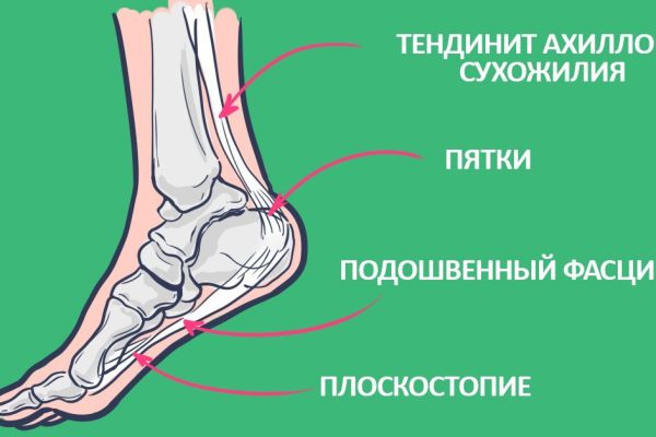 К вечеру ноги устают, наливаются свинцовой тяжестью, гудят… Я знаю решение!