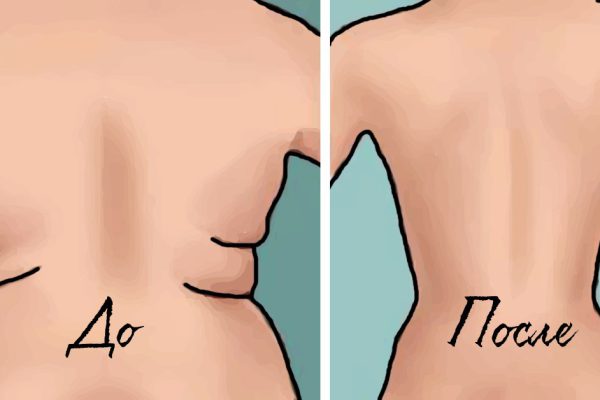 Убери складки на спине и боках при помощи 4 простых упражнений: красивый изгиб уже за 3 недели.
