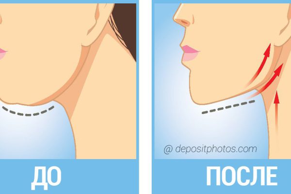 Как убрать второй подбородок тейпами схема