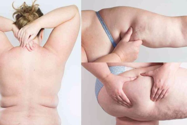 Жир откладывается уже через 3 часа после еды! Не дай ему превратить тебя в пышку…