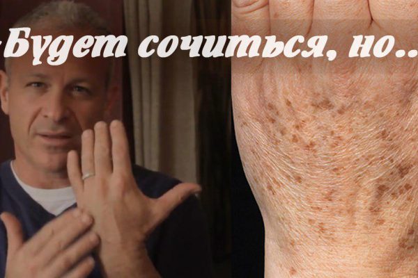 Американский доктор надоумил! Средство из этих двух веществ отбеливает пигментные пятна очень быстро…